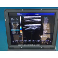 échographe portable ultrason &amp; machine à ultrasons mindray